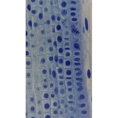 Мікроскоп Bresser Erudit Basic Bino 40x-400x з адаптером для смартфона (5102200) (922746)